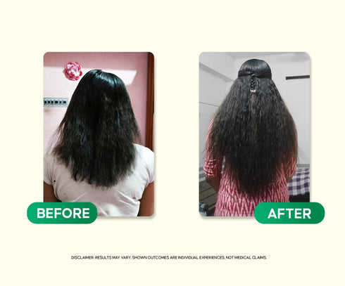 Kesavridhy Hair Growth Oil